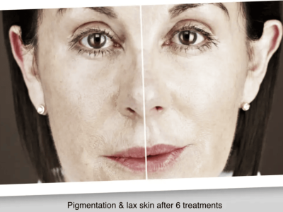 Screenshot 2025-03-04 at 3.38.27 PM-2